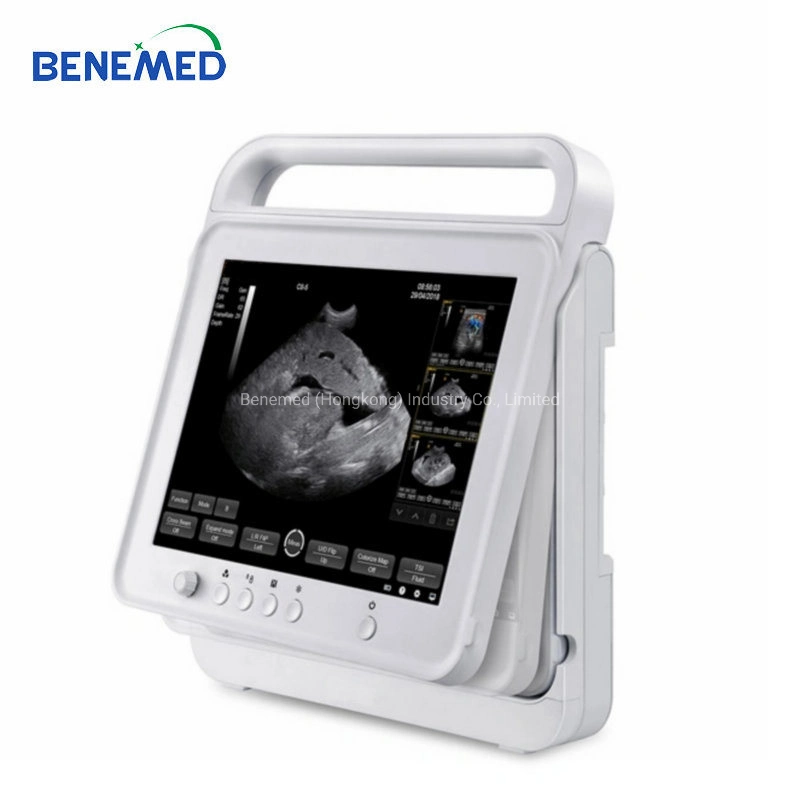 Opu Function Professional Veterinary Hand-Carried Touch Screen Ultrasound Equipment