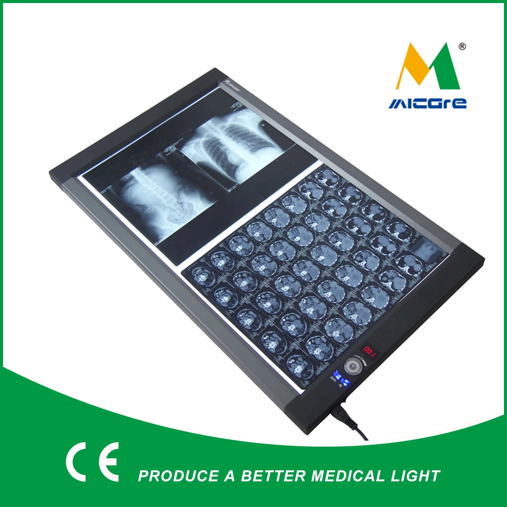 LED Negatoscope Medical Film Viewer Double Screen Zg-2c