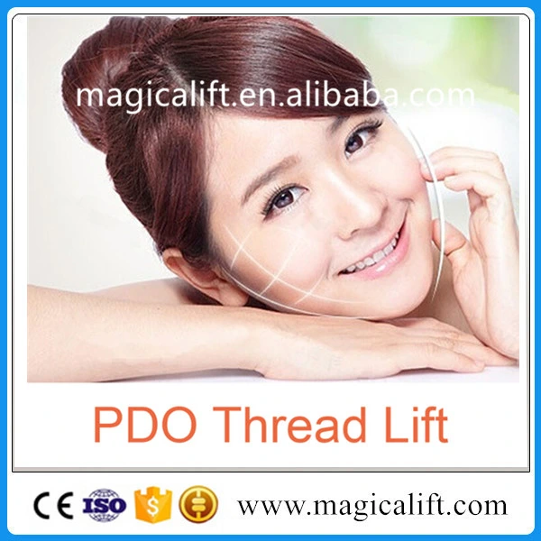 Reyoungel Pdo Cog Thread for Skin Lifting