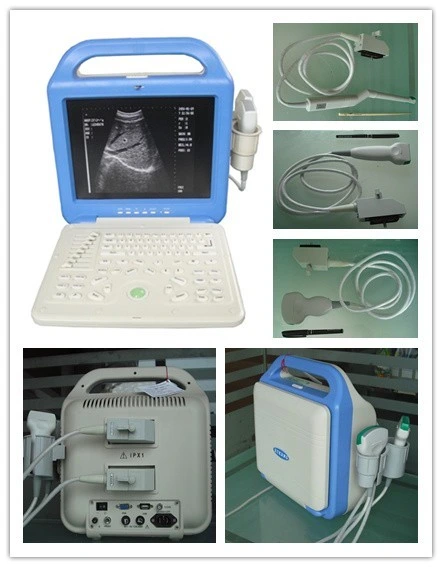 New Portable LCD Display Ultrasound Scanner with a Convex Probe