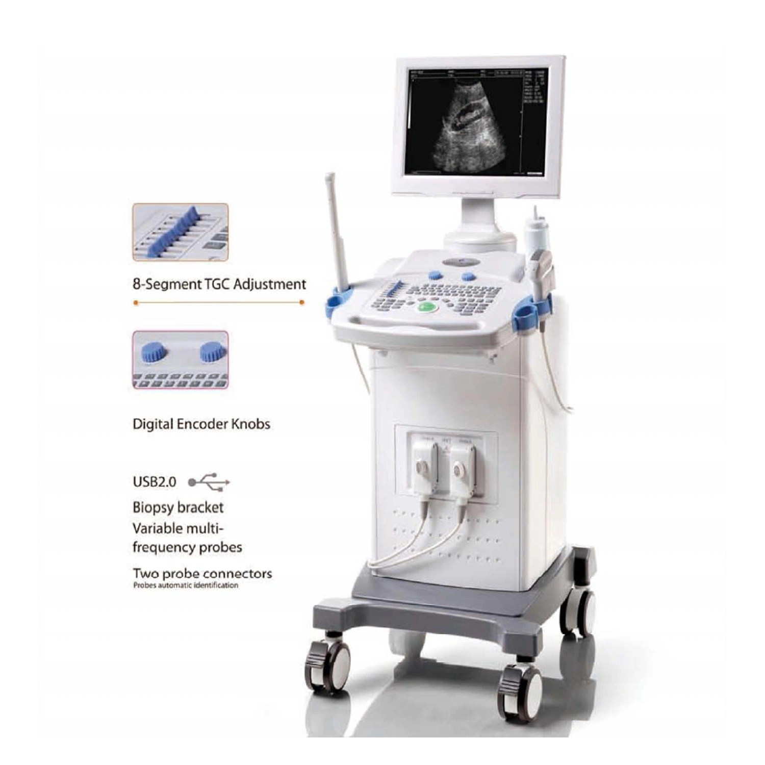 80 Element Digital Trolley Ultrasound Scanner/Ultrasound Machine (PW-9618C)