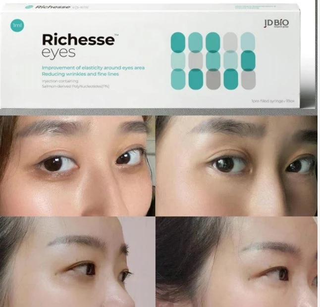 Richesse Eyes Pn Skin Booster Regenerative Remove Bags and Dark Circles Ender The Eyes