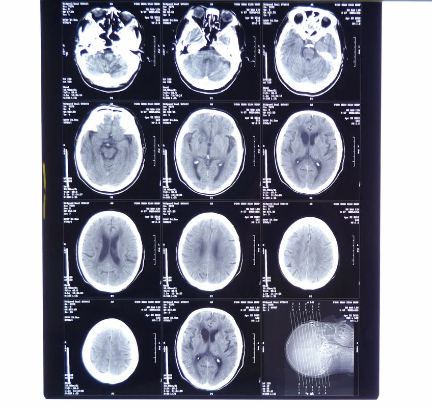 Utilisation de l'imprimante de l'hôpital médical sec radioactifs Blue Film d'impression thermique