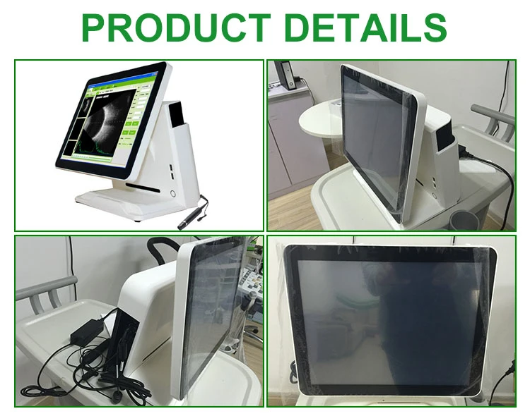 in-A500 China Cheap Price Ophthalmic Ultrasound Scanner Medical Equipment for Biometry Eye Test in Ophthalmology