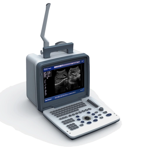 Handeld Black and White Portable Ultrasound Scanner for Convex Probe