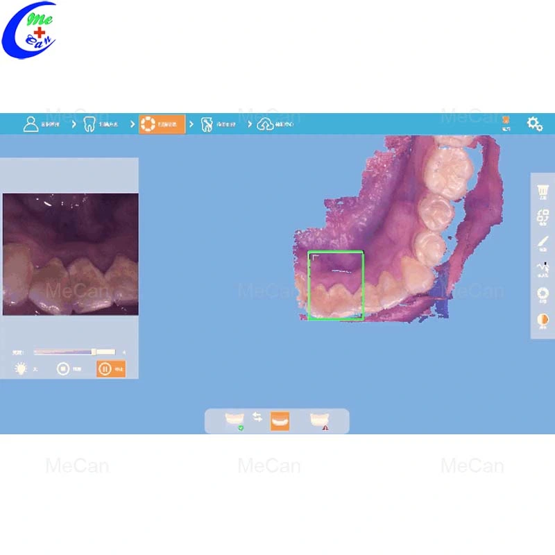 Os equipamentos de laboratório dental 3D Portátil Scanner intraoral