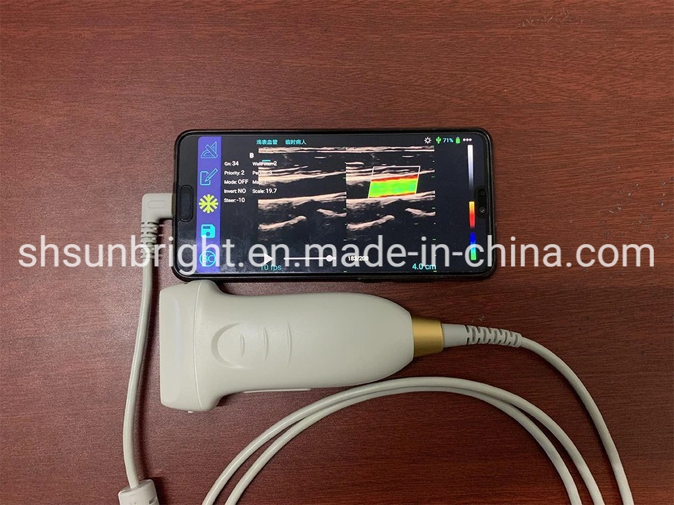 USB Digital Vet Ultrasound Medical 2D Ultrasound Scanning Devices