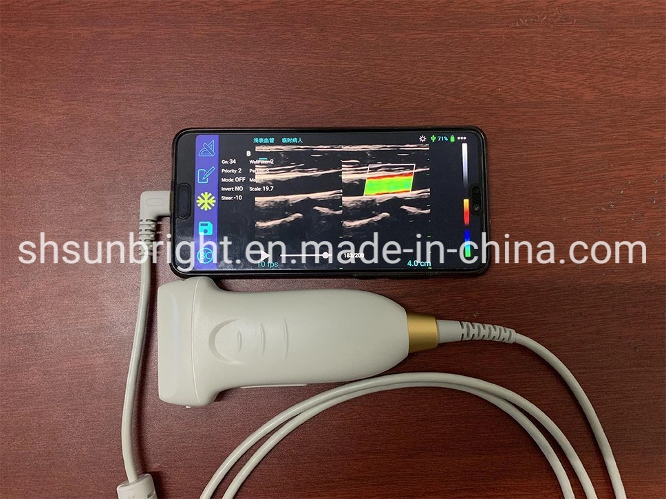 Digital USB Vet médico ultra-sonografia 2D dispositivos de digitalização