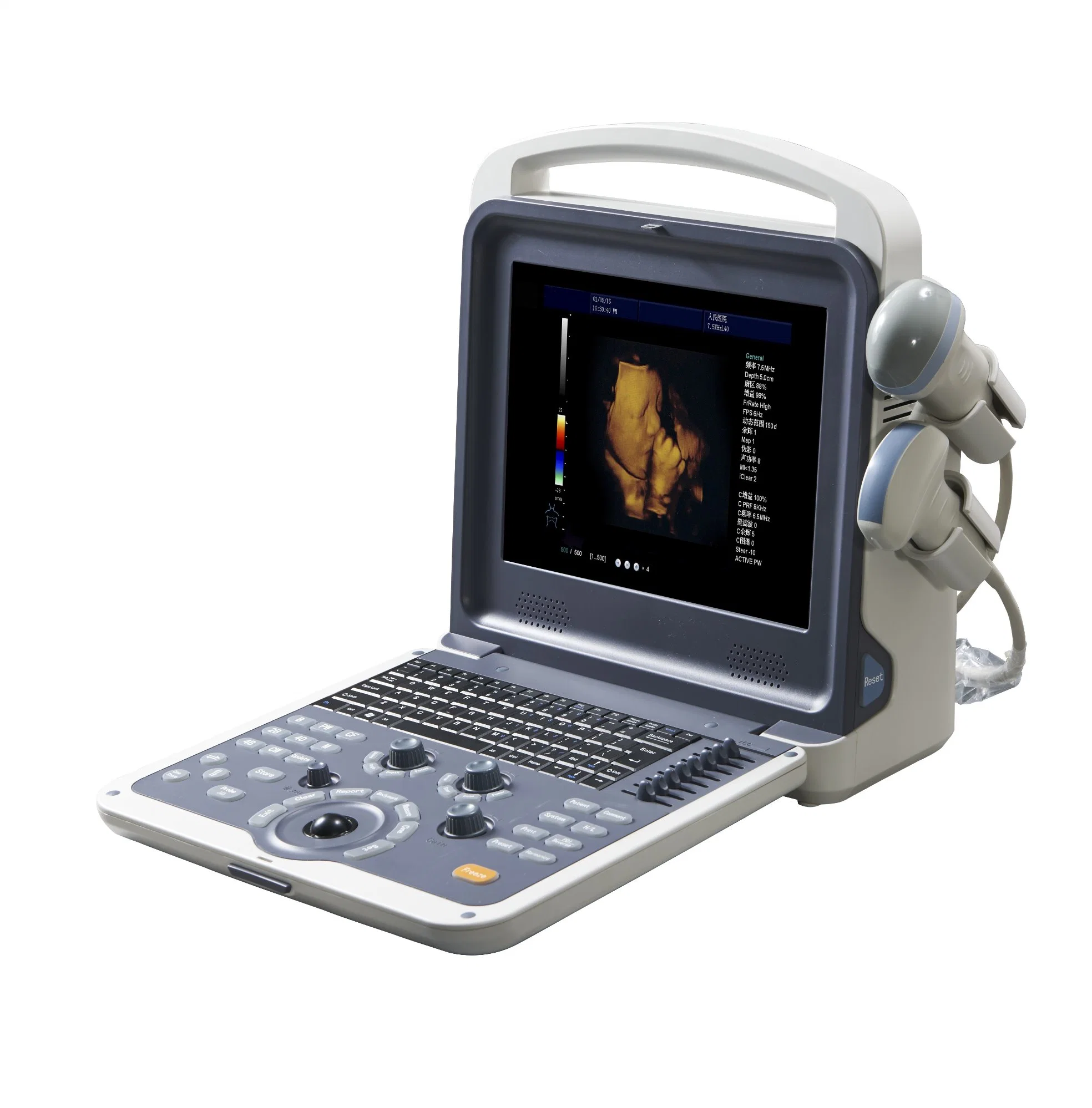 3D/4D imagen Medical Ecógrafo Doppler color similar al de Mindray M9