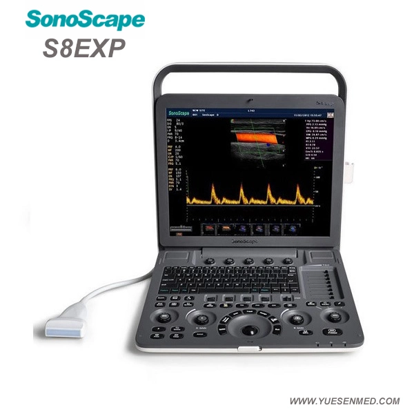 Medical Sonoscape S8exp máquina de ultrasonido Escáner portátil barato