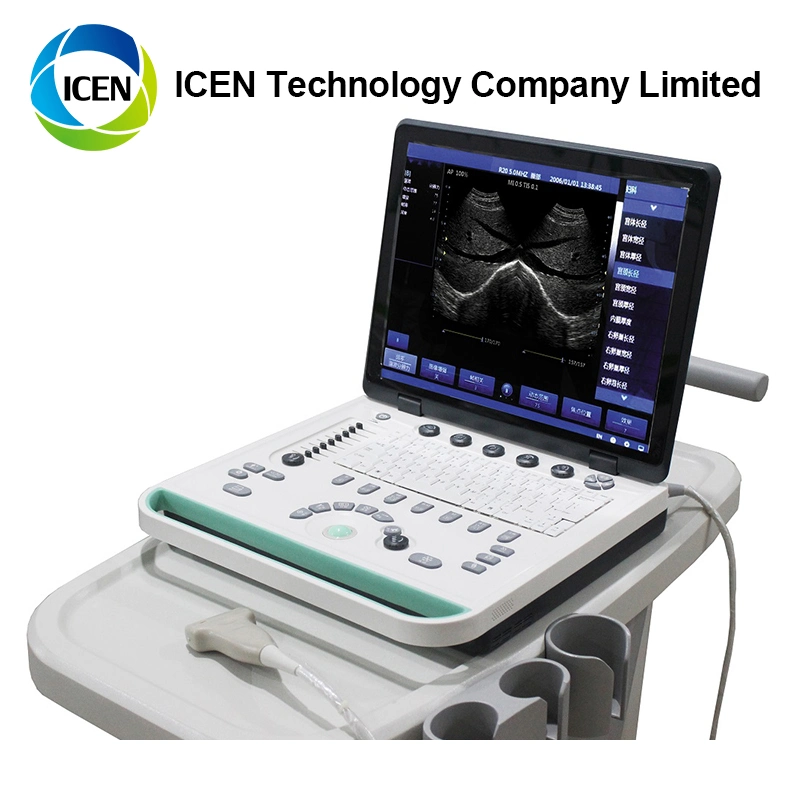 IN-A032-2  adults multi-functional hospital digital pregnant portable ultrasound scanner