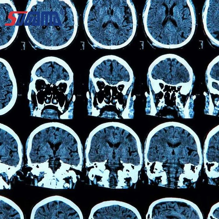 10*12 polegadas sensível ao azul Medical filmes secos de raios X