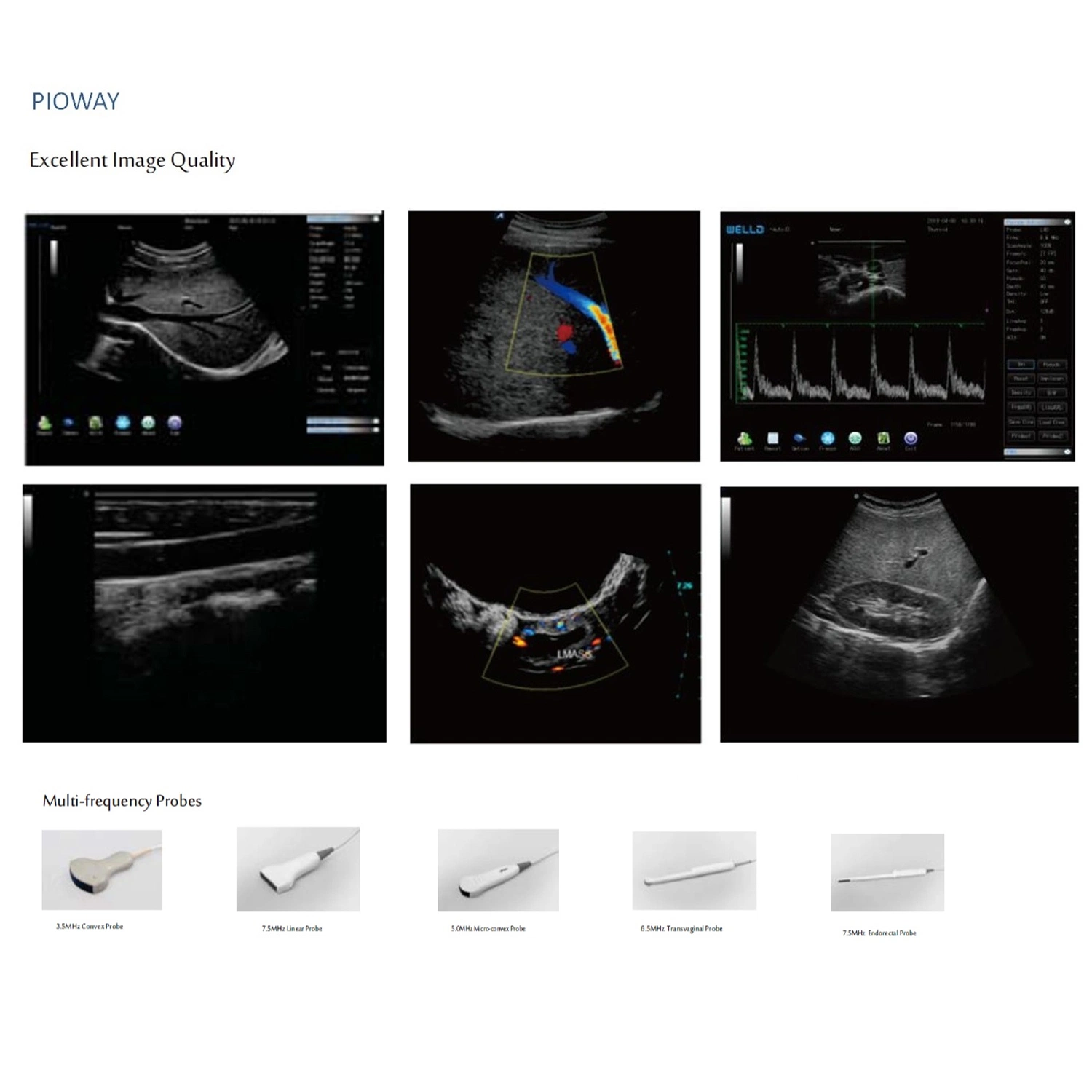 Portable Color Doppler Utrasound Scanner with Ce Certificate (PW-190)