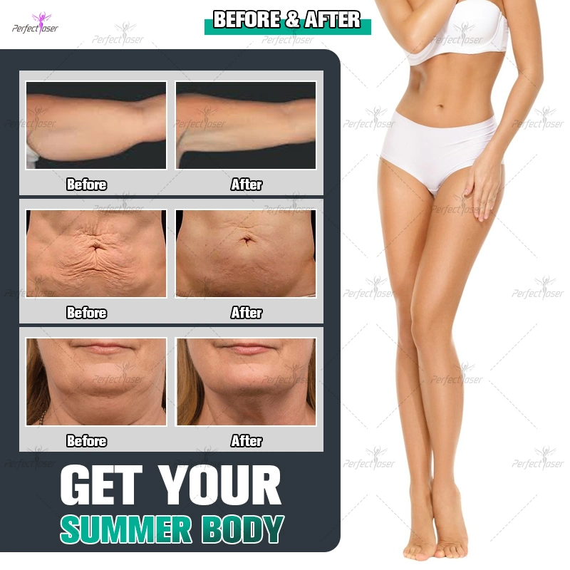 360 Cryolipolysis Slimming Fat Gel Gel de la perte de poids à vide Cryo Lipo laser thérapie Lipolaser RF du système de cavitation Cool Body Sculpting Machine de beauté