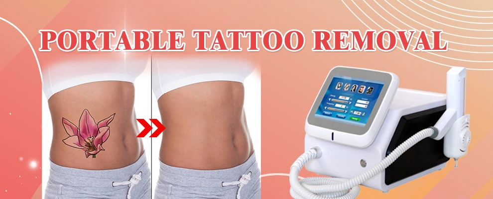 Newest Promotion Laser Pigment Therapy / Q Switch ND YAG Laser Tattoo Removal Equipment