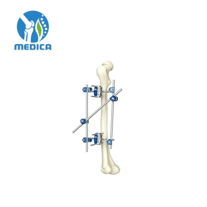 Combinación de cirugía ortopédica la fijación externa gran fractura fijador de rodilla