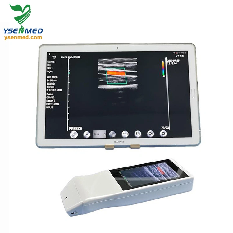 Medical Equipment Ysb-V5p Wireless Color Doppler Probe Ultrasound Medical Equipment