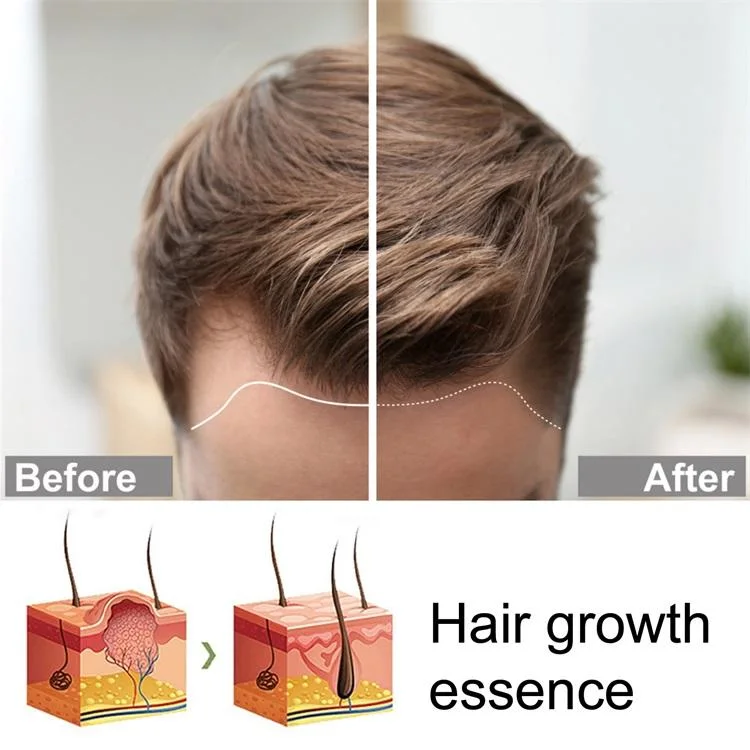 Anti Loss Ginger Serum Hair Growth Essence Spray