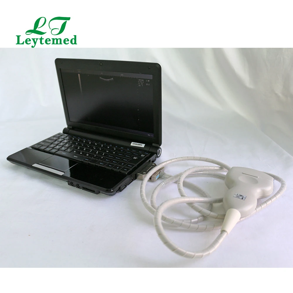 Ltub25 Laptop Portable Full Digital Medical Pregnancy Scanner Ultrasound Echography Equipment