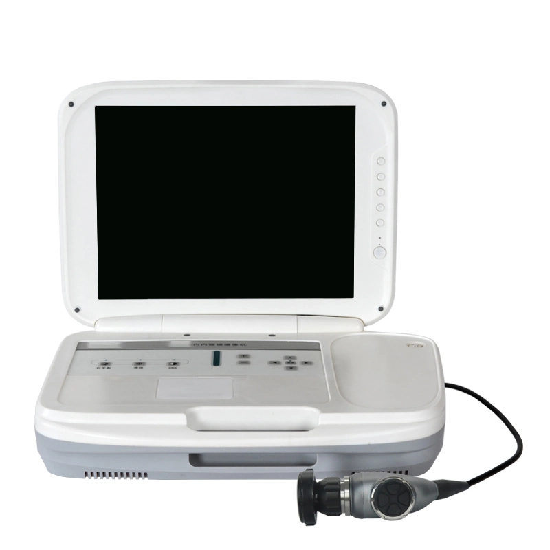 Factory Mobile Ent Endoscopic Visual Chanmed Endoscopy Imaging Medical Endoscope Camera System