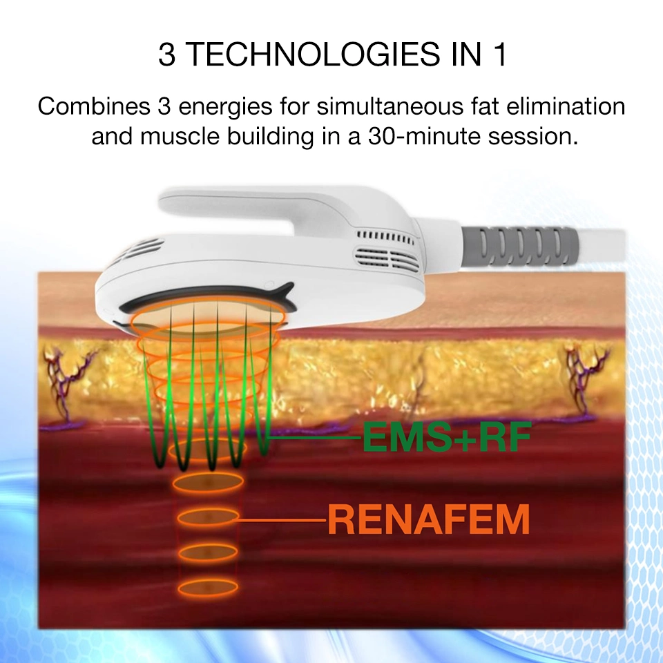 El más reciente Renasculpt 15 Tesla 5 maneja EMS Slim Loss Weight EMS Escultura Belleza máquina de limming