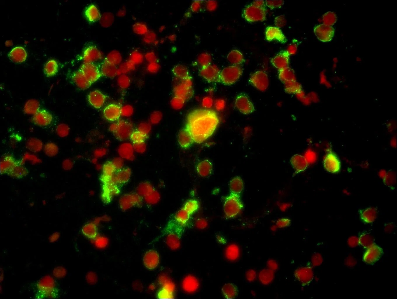 Bestscope BS-2044b microscopio biológico con plan de campo amplio de punto de vista alto Ocular