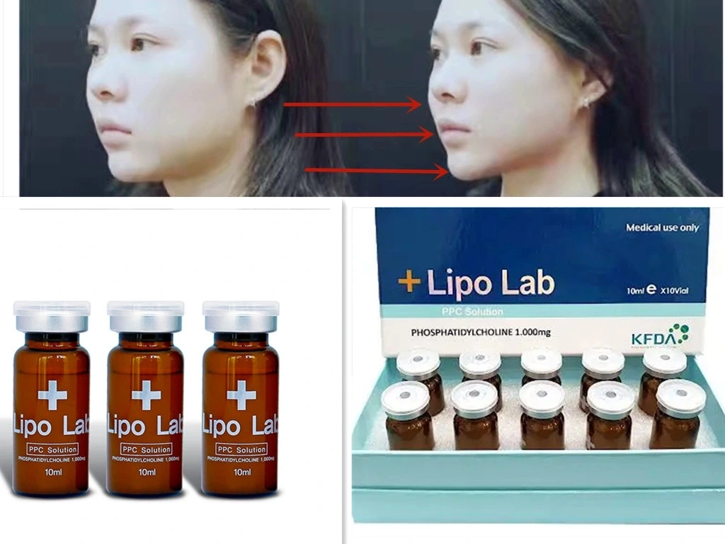 O original de alta qualidade de laboratório Lipo Lipolab Ppc Injecção Lipólise Lipo Lipolítico Lab Coreia Kabelline Lemonbottle Aquelyx Lipo Lab V-Line Kybella