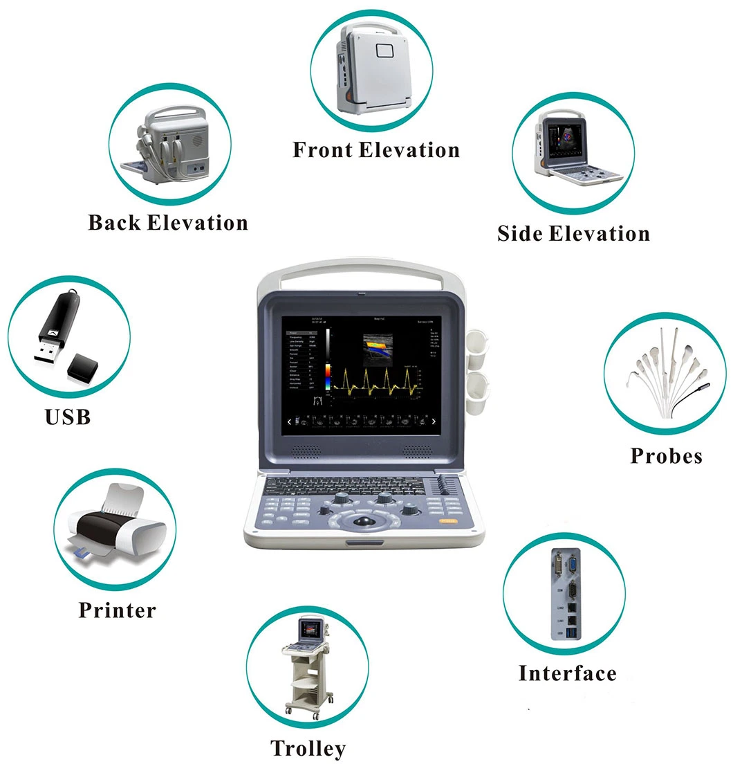 Medical Diagnostic Equipment Portable Digital Color Doppler 4D Ultrasound Scanner