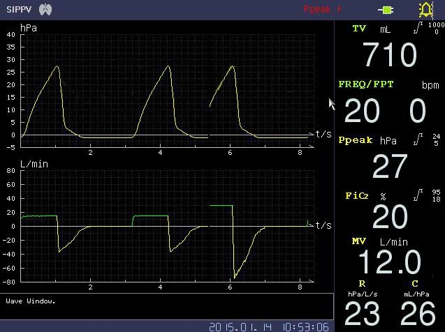 Hersteller Großhandel Krankenhaus Klinik Atemtherapie ICU Medical Ventilator Atmung Betriebsmittel