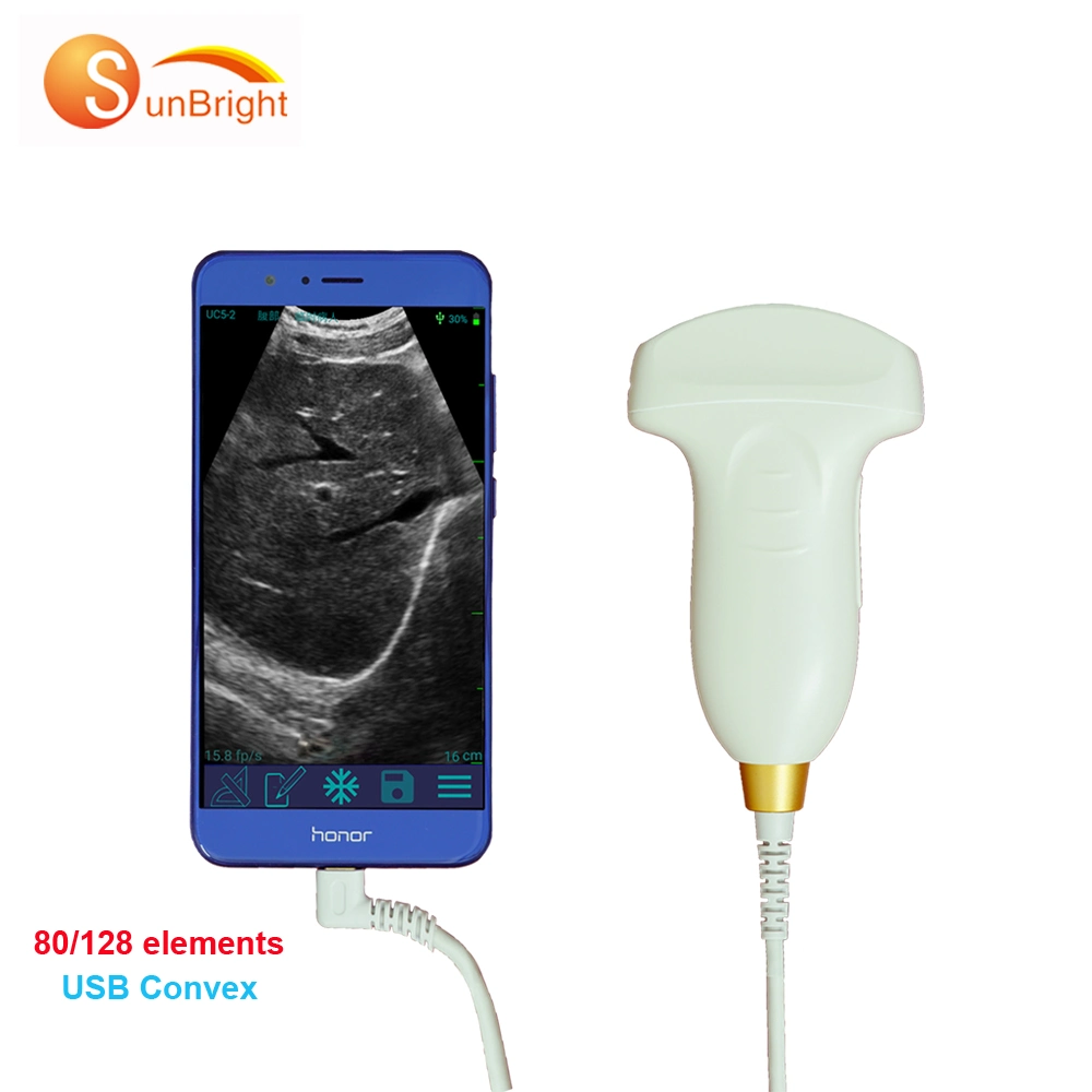 Sunbright Probe Scanner Ultrasonido Portatil USB Ultrasound Transducer with Ce