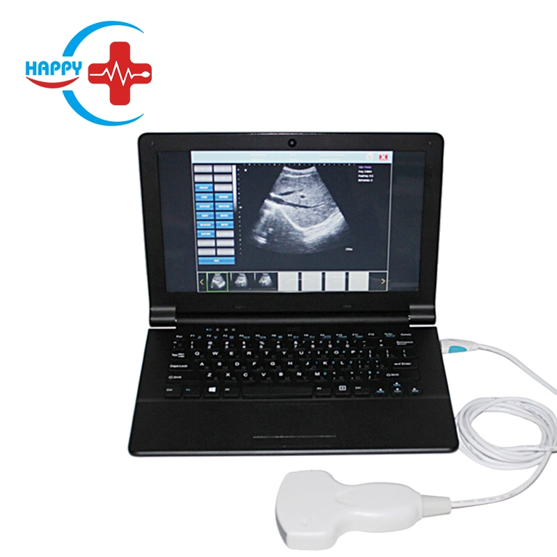 Hc-A008 USB Ultrasound Probe Price for Laptop/USB PC Ultrasound Probe