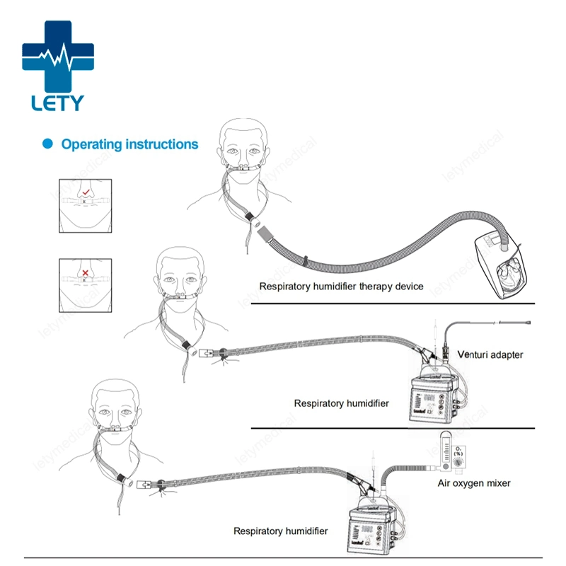 High Flow Nasal Cannula Hnfc Cannula Compatible to Major Manufacturers