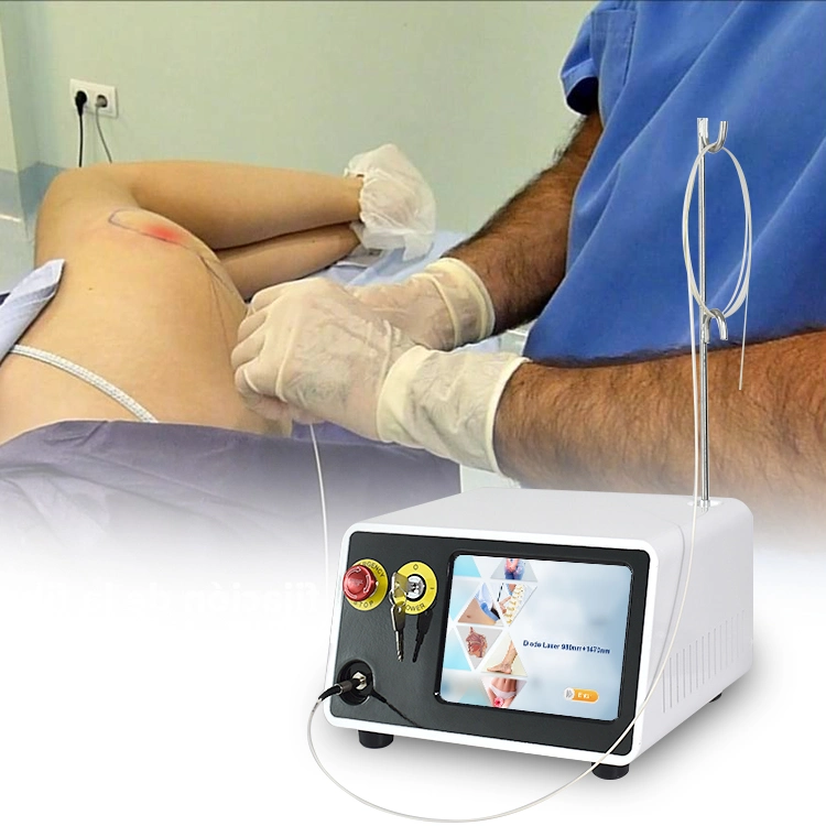 2023 Newest Diodo Lipo Laser Machine 980nm Diode Laser Liposuction /Lipolisis Slimming Machine