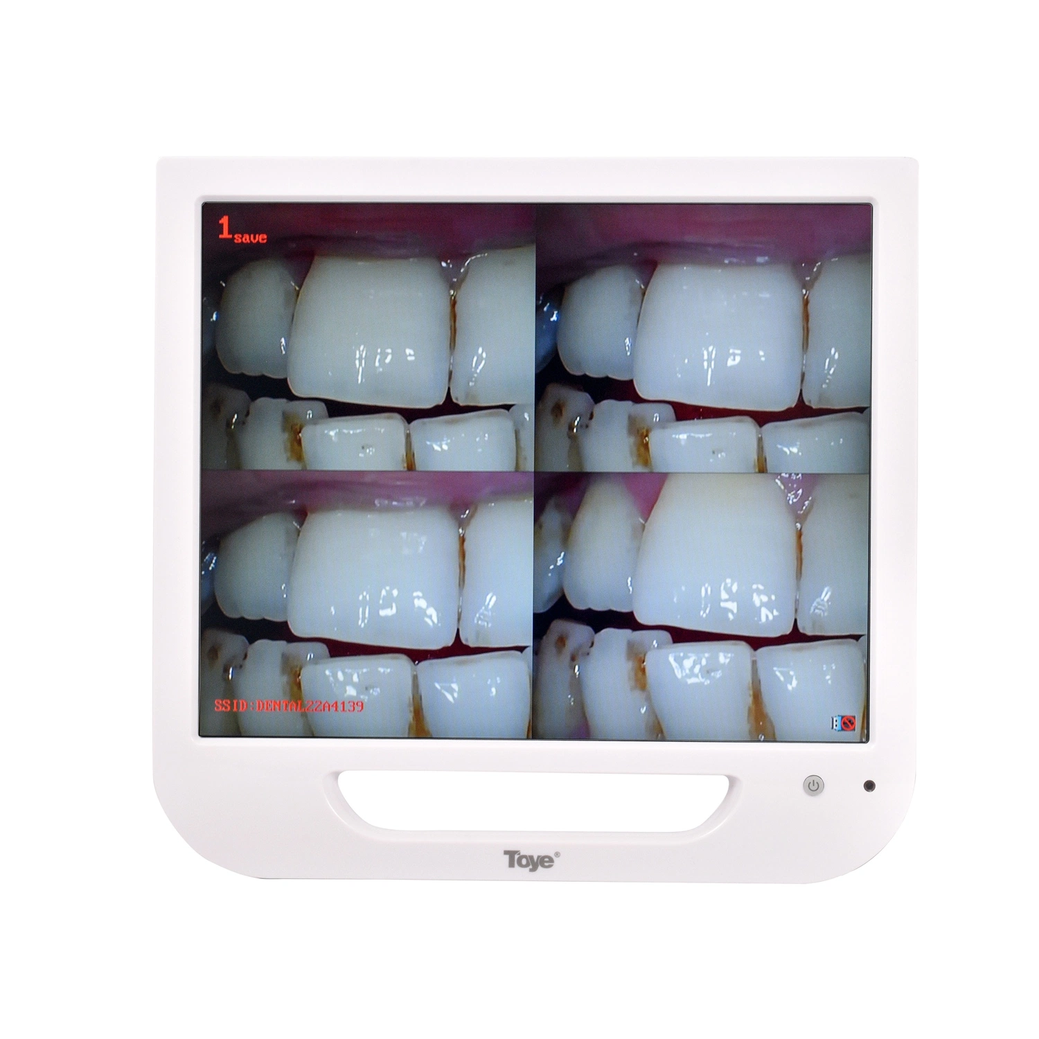 CE ISO Approved Ultra Medical Fine Sensor Digital Viewer 17 Inch LCD Monitor Digital Endoscope Dental Intraoral Camera