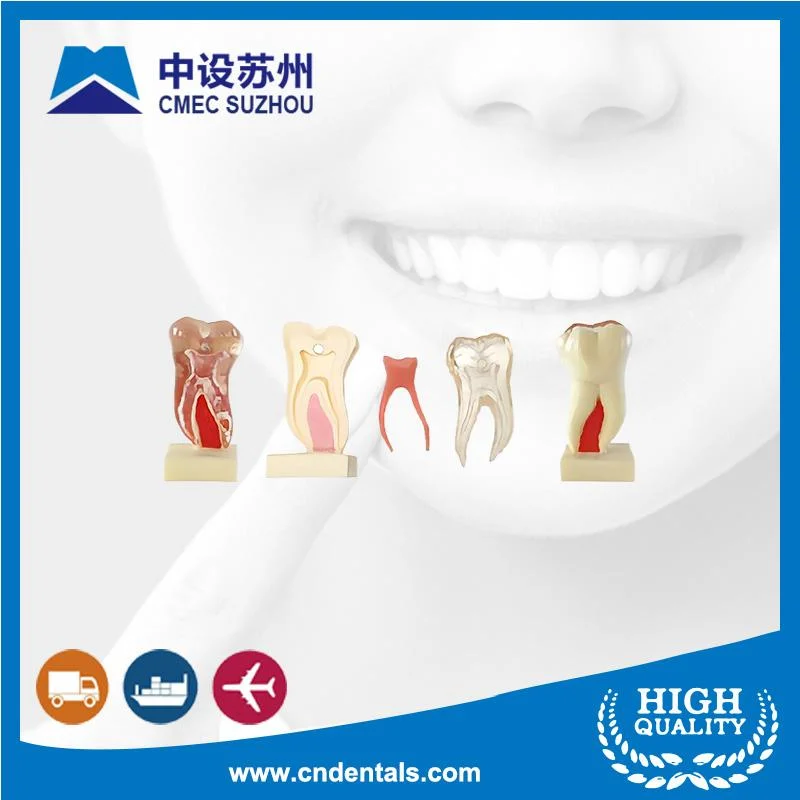 Anatomisches Profilmodell des zahnärztlichen Zahnzahnmodells der mandibulären Molaren (HG-C21)