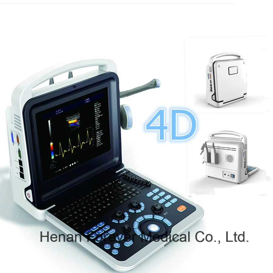 Équipement de diagnostic médical Échographe portable Doppler couleur cardiaque 4D