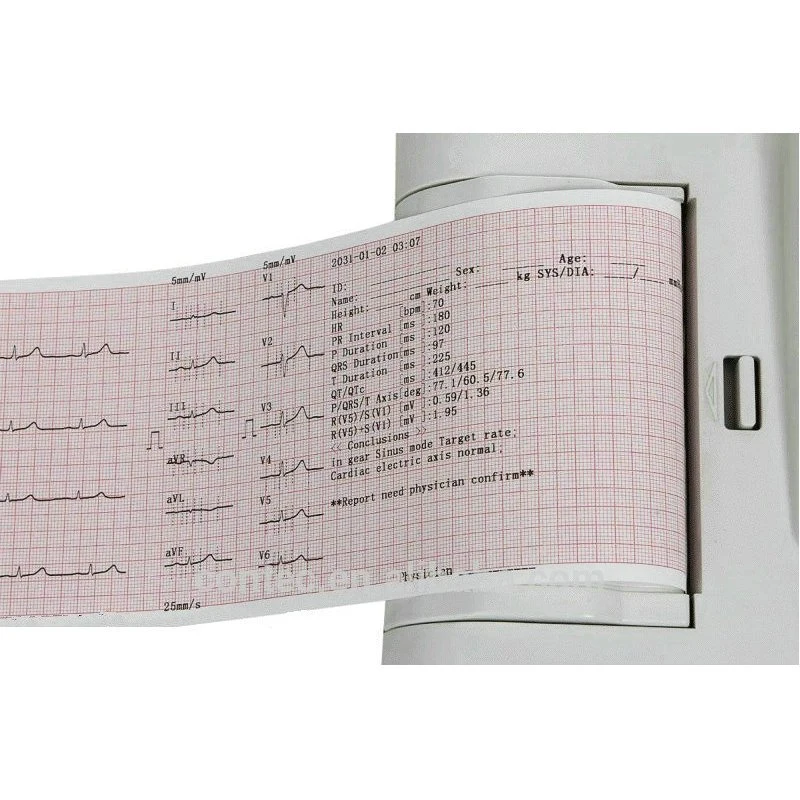 Equipo de Hospital de la pantalla táctil de la máquina máquinas de ECG (ECG600G)