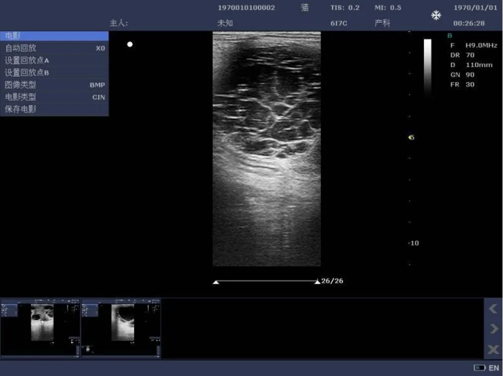 Em-G12 Medical 4D Digital Ultrasound Scanner Portable Medical Ultrasound Machine