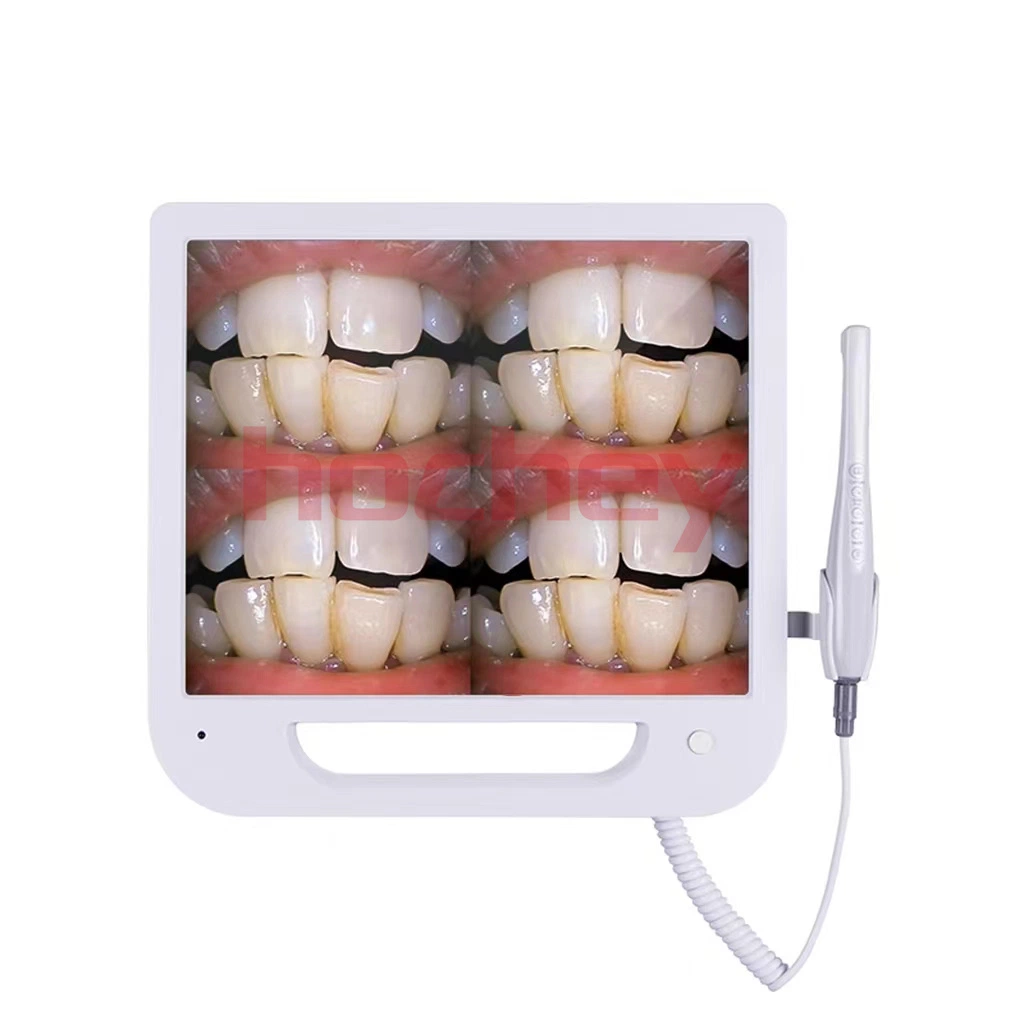 Hochey медицинских ручной сканер полости рта беспроводной HD внутри камеры полости рта Dental эндоскопа WiFi внутри камеры полости рта для зубов уход