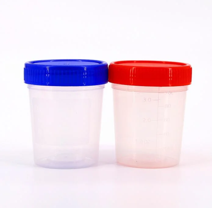 Medical Sterile Container Sample 60 Ml Disposable Urine Cup