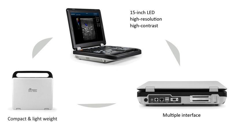 Full Digital Portable Color Doppler Ultrasound System, Sonography, 4D Ultrasound, 3D Ultrasonic