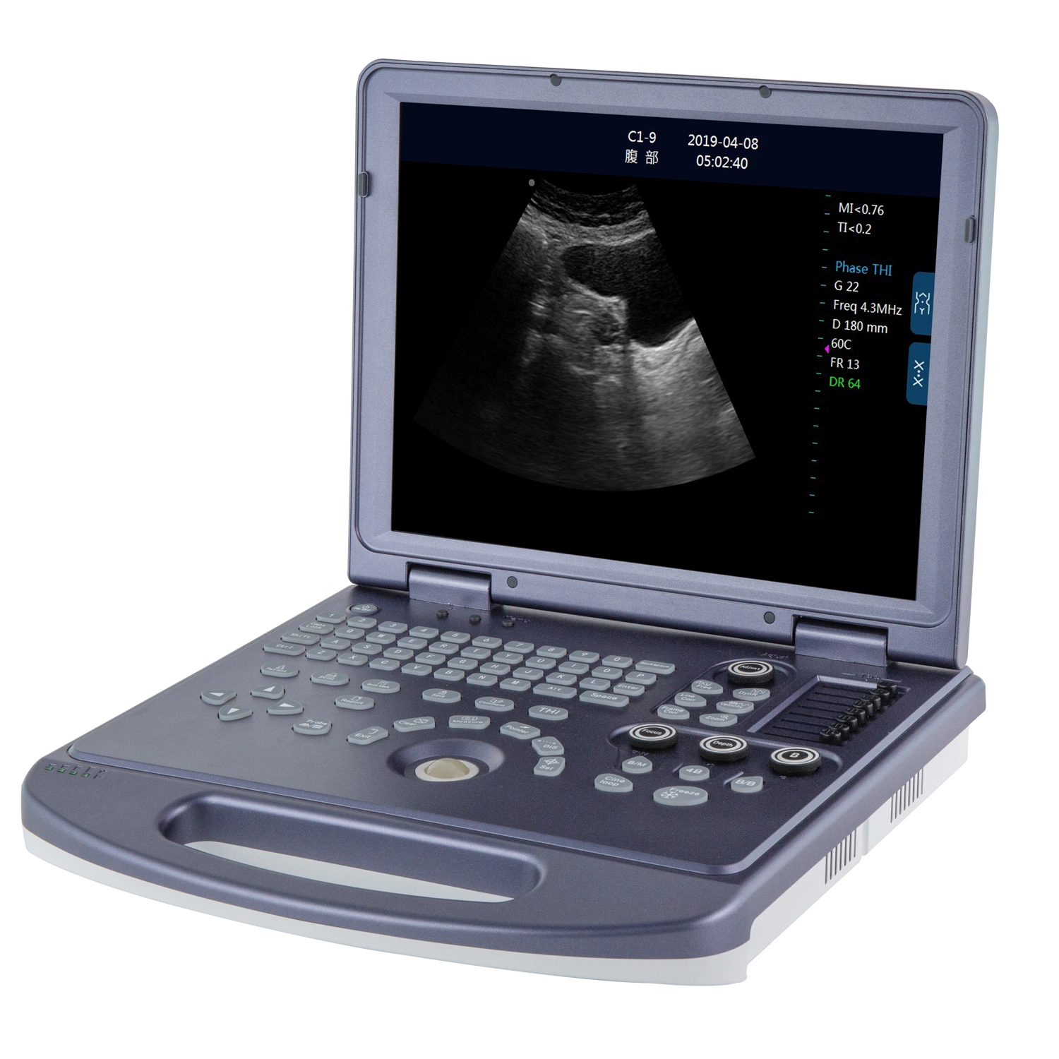 Laptop Full Digital Ultrasonic Diagnostic Instruments Ultrasound Sonography Machine