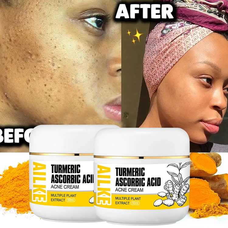 Private Label Fresh Glow Creams Organic Mens Anti Age Acne Beauty Best Moisturizer Face Cream for Fair Skin