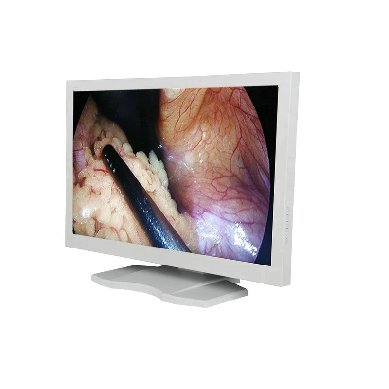 Urology Endoscope Complete Set, Urology Cystoscope Camera Endoscopic Equipment