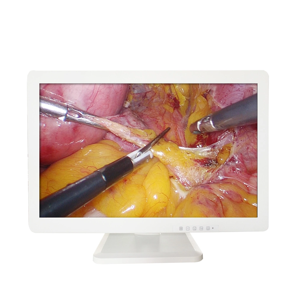Grade Shutterstock Ba Medical Cyborg HD Screen Endoscopy Endoscope Monitor