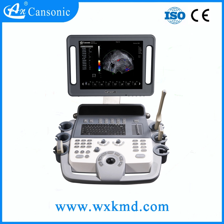 China Wuxi Ultrasound Machine