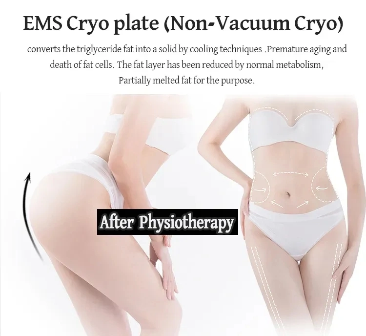 2 in 1 Cryo Shockwave Slimming Kryotherapie Gebläse Luft Haut Kühlmaschine