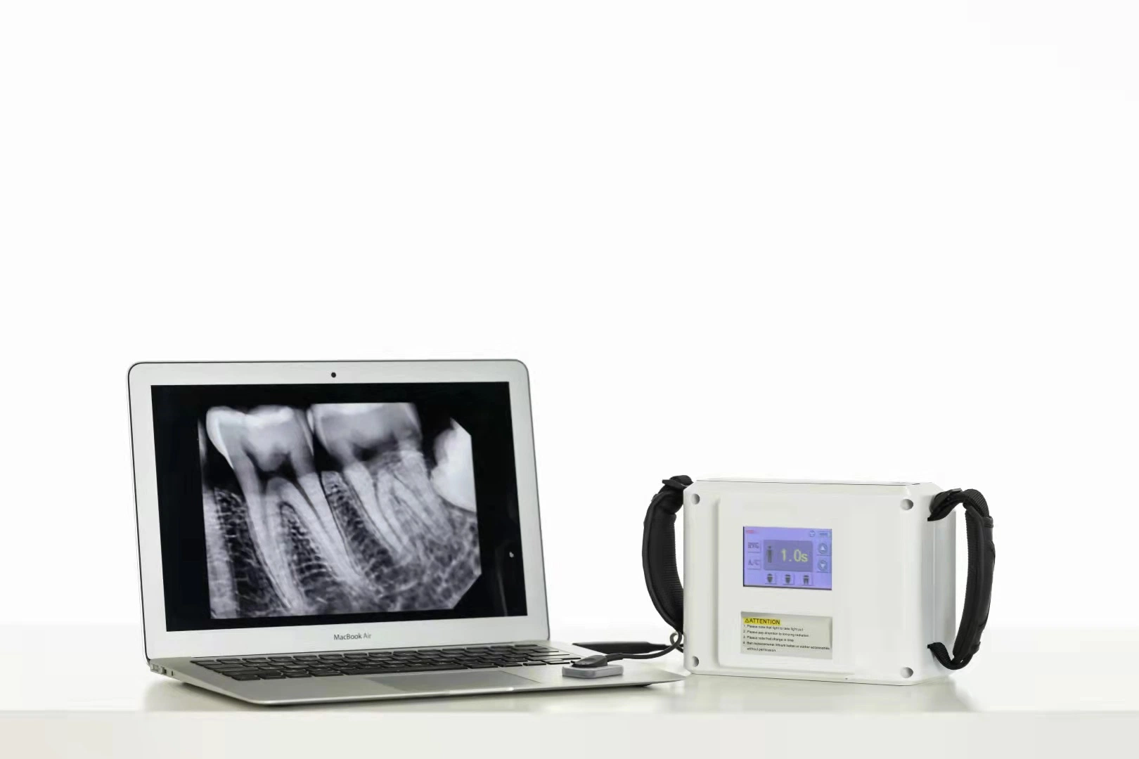 Intra-Oral Medical Dental X-ray Equipment Small Digital Handheld Camera