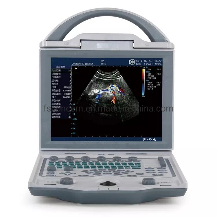 PET Hospital Digital Color Doppler Ultrasound instrument de diagnostic échographie vétérinaire