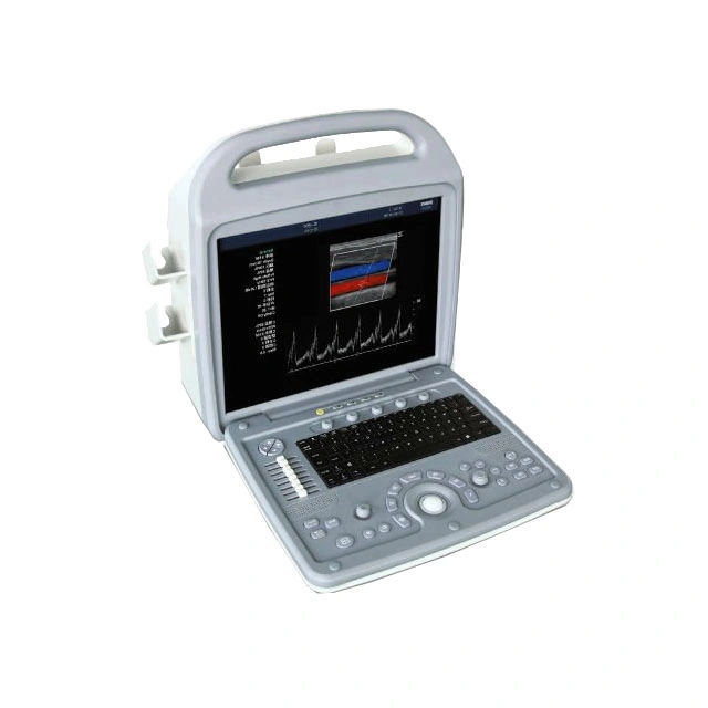 3D Color Doppler Portable Ultrasound Scanner (THR-CD580)